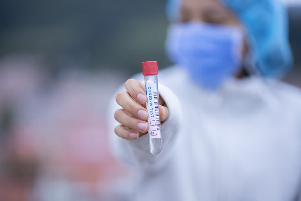 Kada ima smisla napraviti serološki test i jesmo li sigurni ako imamo veliku količinu antitijela?   
