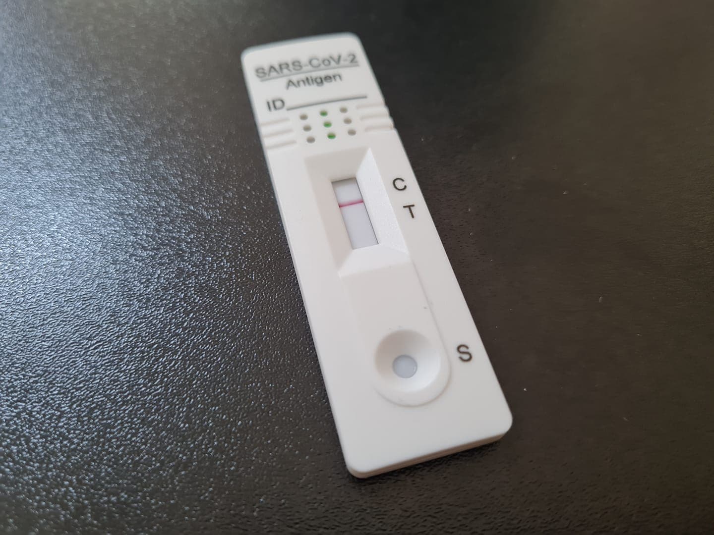 Zašto se neki ljudi ne mogu zaraziti koronom?