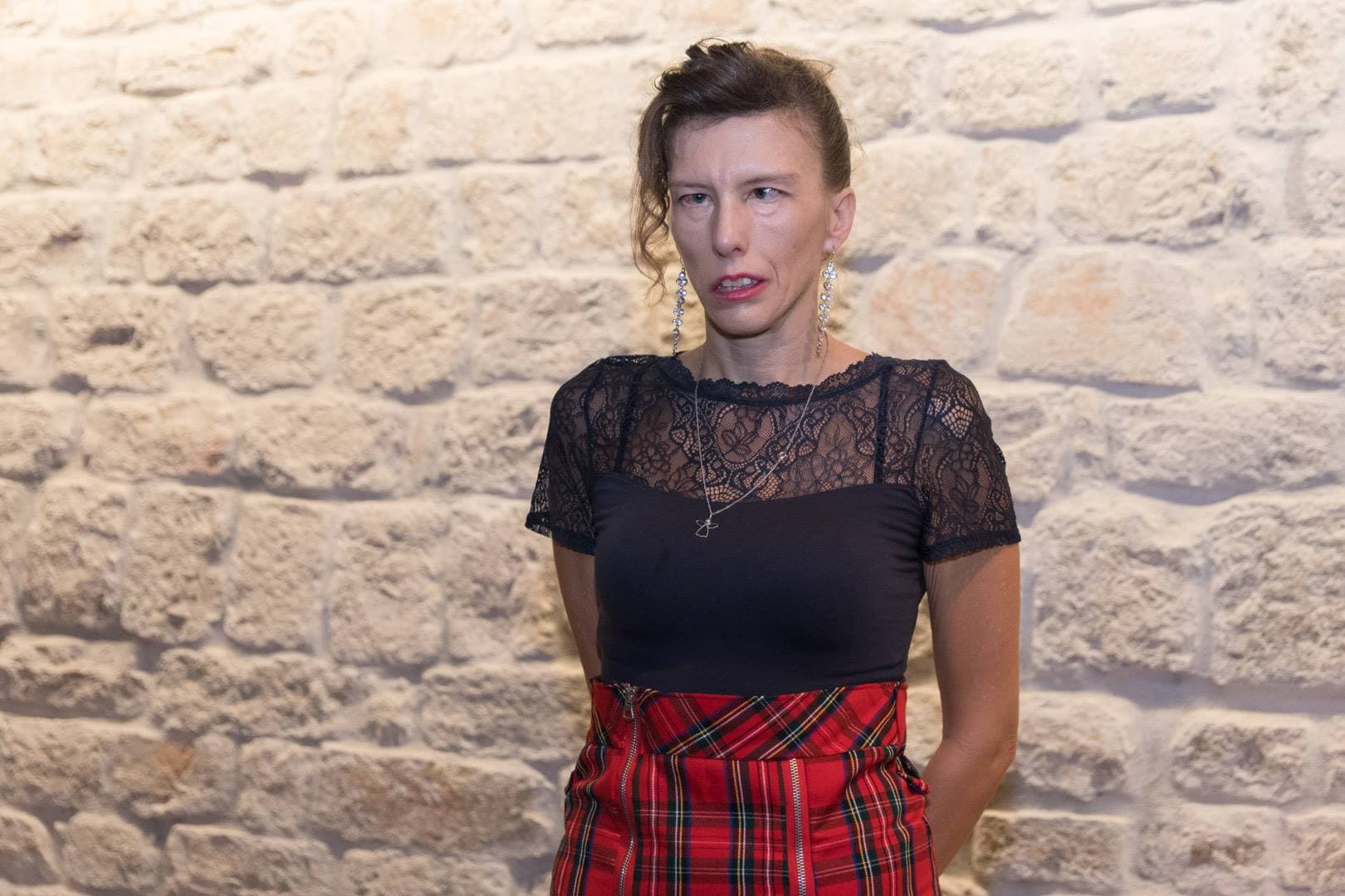 Karmen Herceg na novu protezu mora čekati tri godine: 'Sramite se, trebali bi vi s ovim živjeti tih godinu dana'   