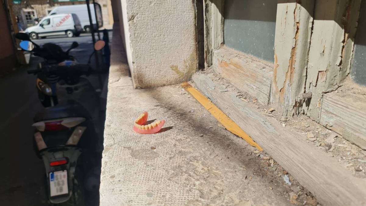 Ako vidite da nekom nedostaju svi zubi donje čeljusti, na Mimincu su mu...