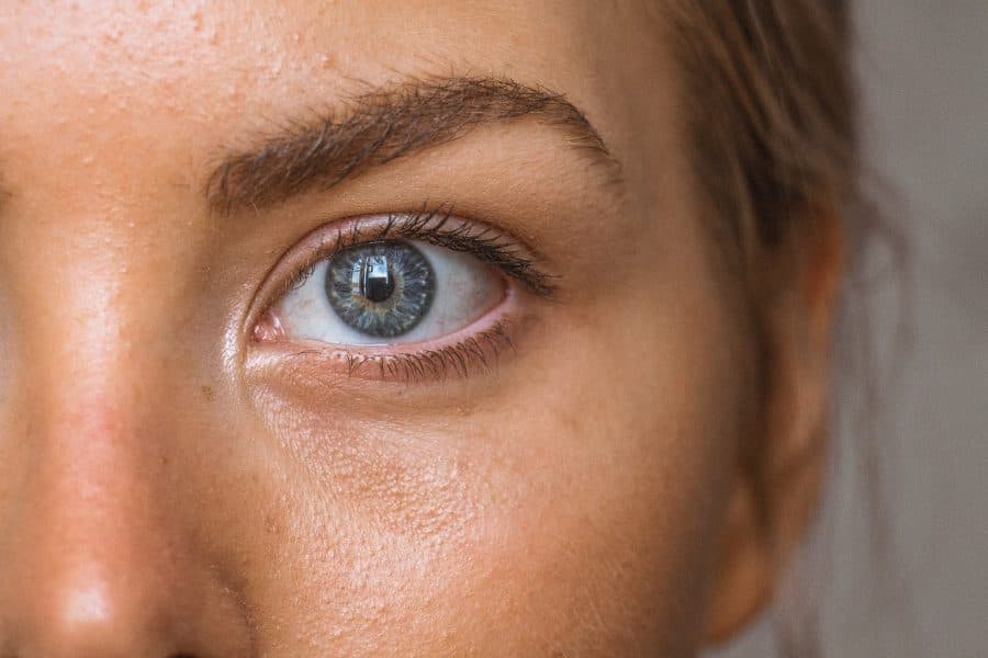 Bakterijski konjunktivitis: Uzrok, simptomi i kako liječiti ovu neugodnu bolest? 