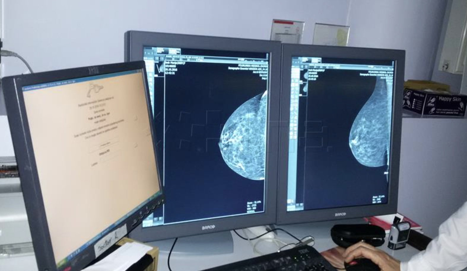 Mobilni mamografi mogli bi poboljšati rezultate programa ranog otkrivanja raka dojke